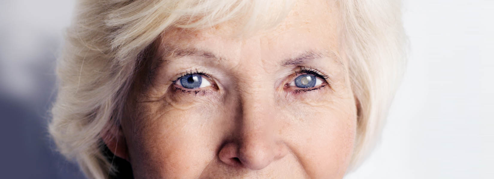 Cataract Surgery in Mount Scott - Arleta